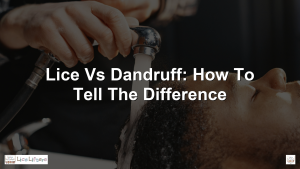 Lice vs Dandruff: How to Tell the Difference