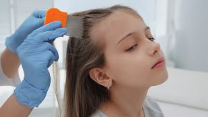 How Do You Comb Lice and Nits Out of Hair?
