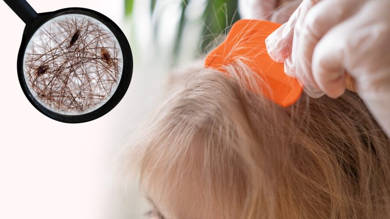 How Long Does the Head Lice Life Cycle Take?