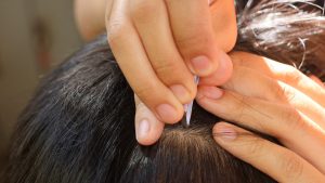 Close-up of a parent's hand using small tweezers to lift a single louse from a child's dark hair during an at-home lice check.