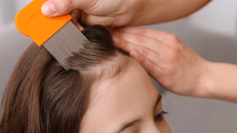 How Long Does the Head Lice Life Cycle Take?