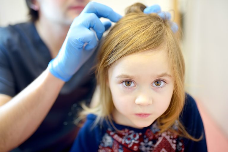A Study Tested 27 Lice Kits. Most Left Nits Behind
