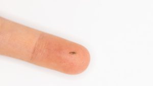 An Adult Louse Is Bigger Than Most Parents Expect
