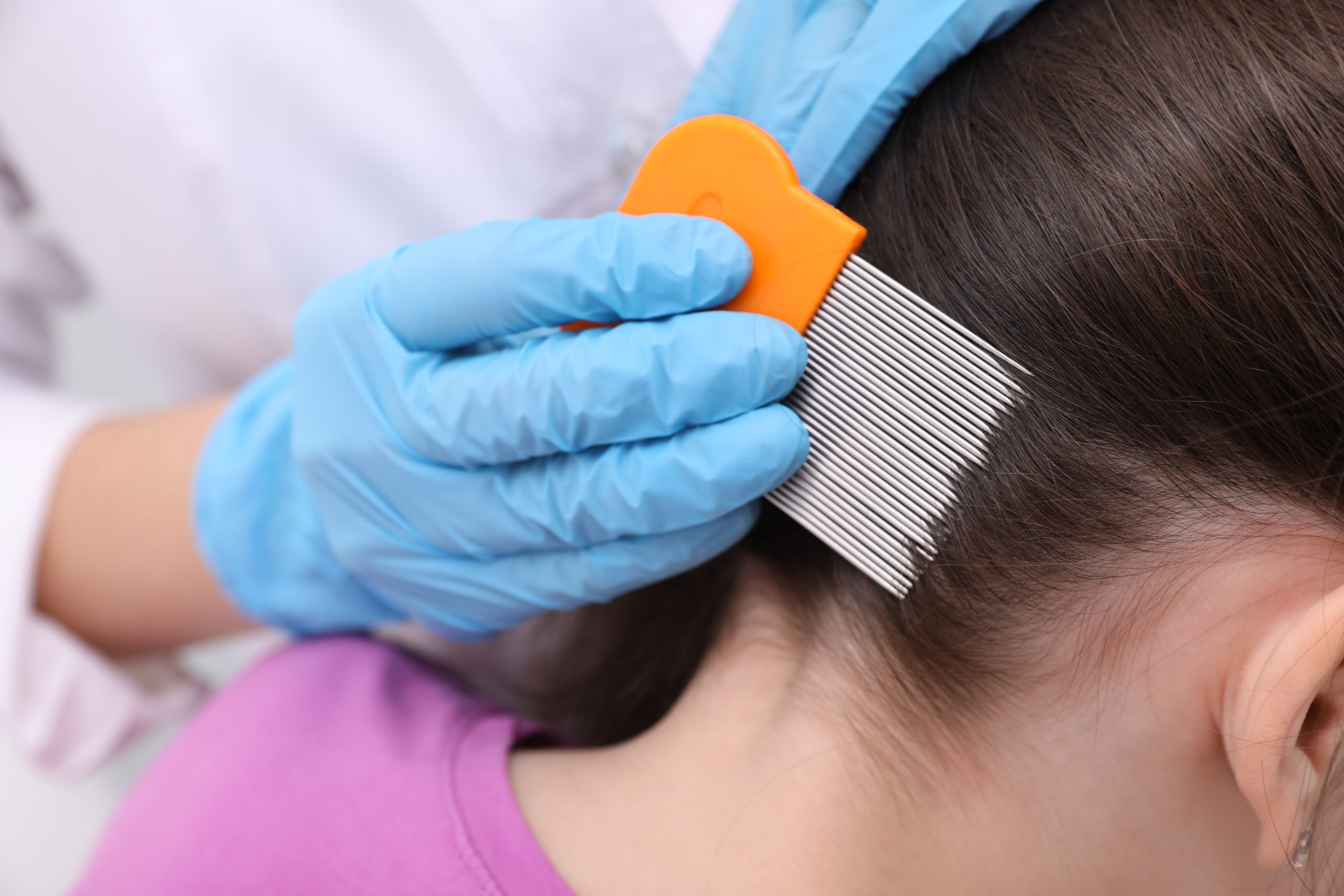 Professional using a fine-tooth nit comb during lice treatment.