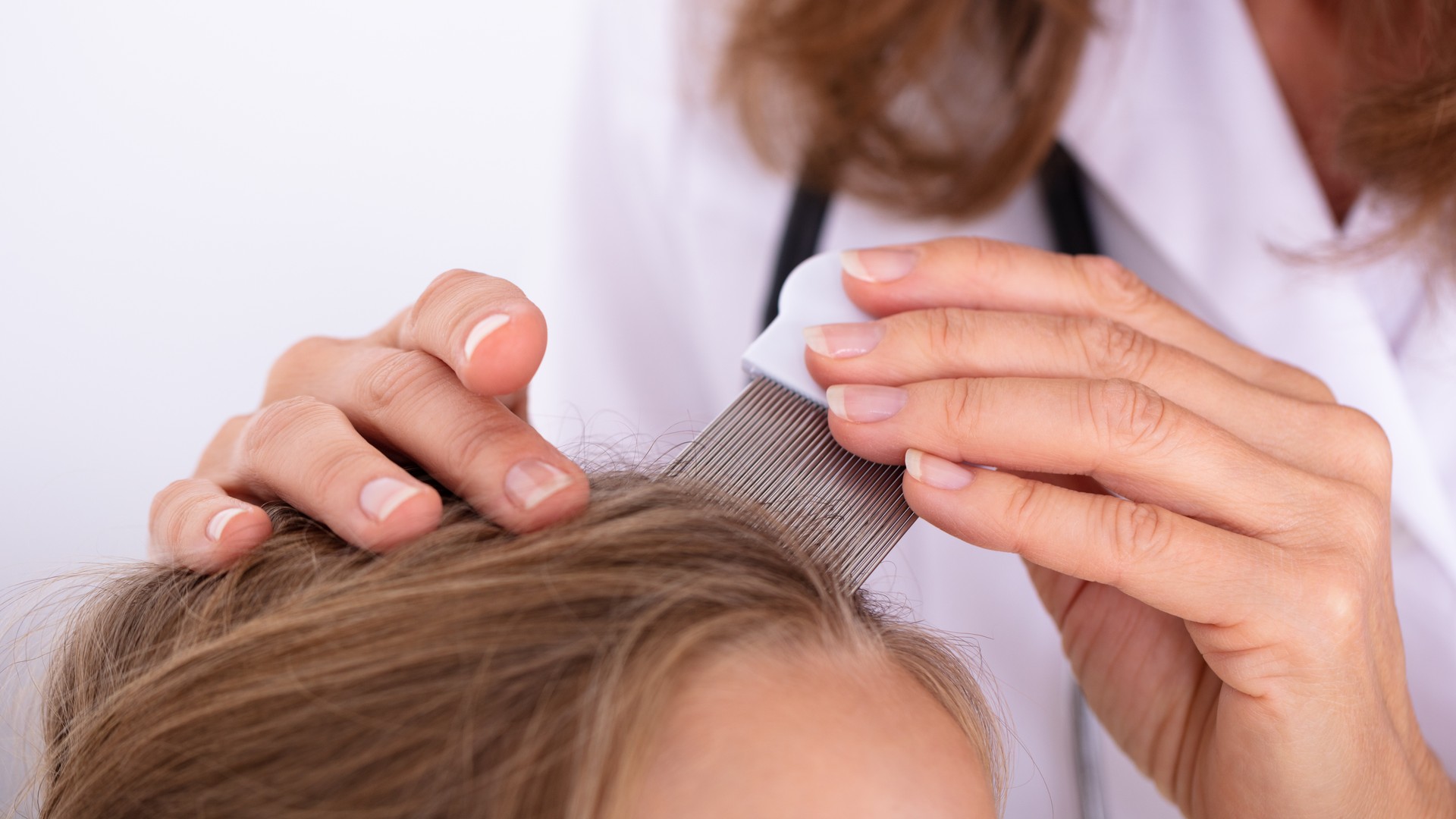 Upgraded: Why Does My Head Still Itch After Lice Treatment?