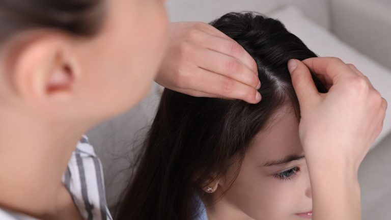 What to Do When Daycare Sends Home a Lice Notice