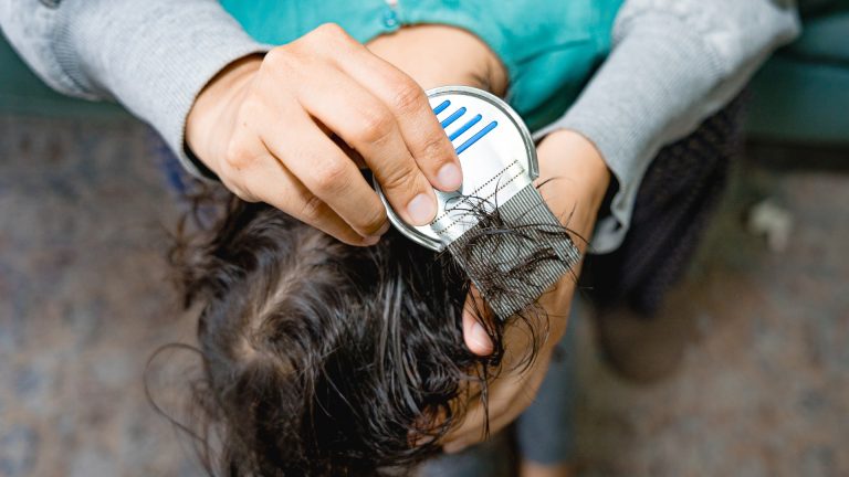 Why Nobody Can Quote Lice Removal Without Asking First