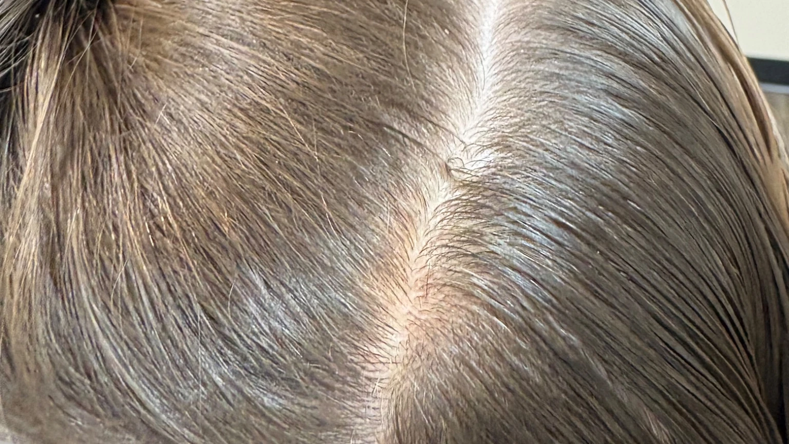 Close-up of a child's damp brown hair parted down to the scalp during a head check